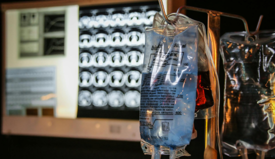 Serum Tedavisi Nedir? Ne Zaman Yapılmalıdır?