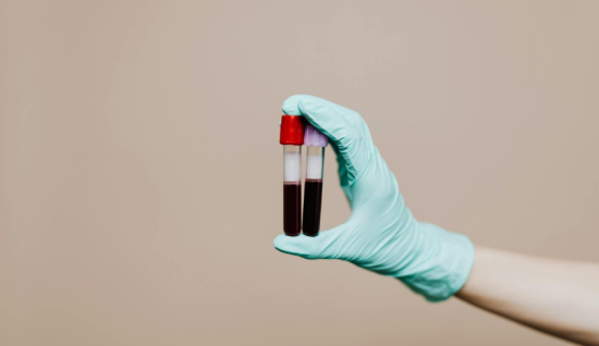 Kan Tahlili Öncesi Nelere Dikkat Edilmeli?